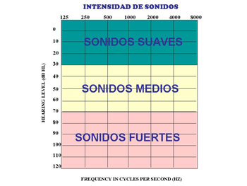 Grados de Hipoacusia